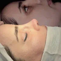 جراحی زیبایی اقساطی اسلیو ابدو بینی پروتز|خدمات آرایشگری و زیبایی|تهران, یوسف‌آباد|دیوار