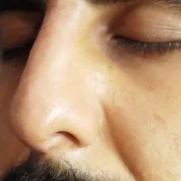 اصلاح فرم بینی بدون جراحی|خدمات آرایشگری و زیبایی|رشت, بلوار گیلان|دیوار