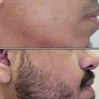 شکلات برای ریشات