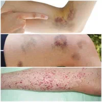 روغن تراپی|آرایشی، بهداشتی، درمانی|نهبندان, |دیوار