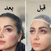 ژل لب فقط ۳۸۰