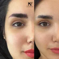 تخفیف استثنایی میکروبلیدینگ وکلیه خدمات ارایش دائم|خدمات آرایشگری و زیبایی|رشت, لاکانی|دیوار