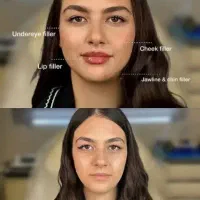 جشنواره یلدایی ژل لب کانتورینگ مزوژل لیفت صورت|خدمات آرایشگری و زیبایی|تهران, تهرانپارس جنوبی|دیوار