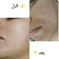 آموزش و خدمات پوست و فیشال|خدمات آرایشگری و زیبایی|مشهد, هفده شهریور|دیوار