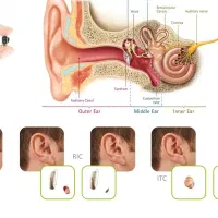 سمعک هوشمند2025