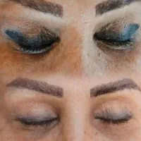 ریموو و پاک کردن تخصصی تتو ابرو چشم لب بدون لیزر