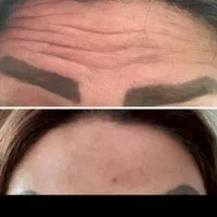 تتو ابر‌و میکروبلیدینگ شیدینگ ژل ومزو و وپی ارپی|خدمات آرایشگری و زیبایی|شوشتر, |دیوار