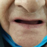 دندانسازی (ساخت دندان مصنوعی تعمیر دندان مصنوعی )|خدمات آرایشگری و زیبایی|تهران, مشیریه|دیوار