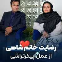 جراحی زیبایی ابدومینوپلاستی لیپو بوتاکس رایگان|خدمات زیبایی و سلامت|تهران, قبا|دیوار
