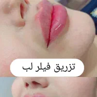 آموزش تزریق ژل بوتاکس و...|خدمات آموزشی|خرم‌آباد, |دیوار