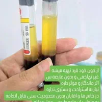 تزریق فیلر وبوتاکس مزو آنزیم پی ارپی و چربی|خدمات آرایشگری و زیبایی|کرمانشاه, |دیوار