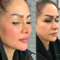 خدمات زیبایی تخصصی با قیمت‌های استثنایی|خدمات آرایشگری و زیبایی|مشهد, راهنمایی|دیوار