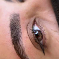 میکروبلیدینگ و فیبروز کرکی مویی