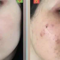 آموزش درست کردن بهترین کرم معجزه بشرط تضمینی