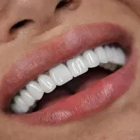 دندان پزشکی/دندانسازی/کامپوزیت/روکش/عصب کشی