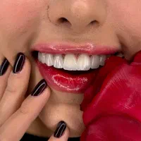 کامپوزیت دندان با اقساط بدون سود و بهره