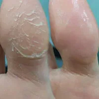 تخفیف در لاین کراتین و احیا.پدیکور.پاکسازی و فشیال|خدمات آرایشگری و زیبایی|کرمانشاه, |دیوار
