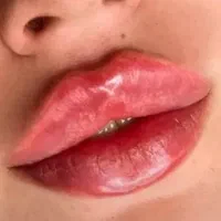 جشنواره تخفیف ژل و بوتاکس کلینیک راد|خدمات آرایشگری و زیبایی|کرج, برغان|دیوار