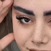 فیبروز و ترمیم تخصصی ابرو