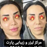 خدمات ژل بوتاکس چربی با زیباترین نتایج وقیمت مناسب|خدمات آرایشگری و زیبایی|دوگنبدان, |دیوار