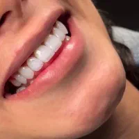 تخفیف ویژه کامپوزیت یلدایی|خدمات آرایشگری و زیبایی|شیراز, قصرالدشت|دیوار