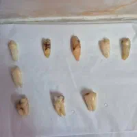 دندان|پزشکی|رشت, گلسار|دیوار