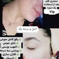 کرم vip بزرگ ضدلک و سفید کننده|آرایشی، بهداشتی، درمانی|گرگان, |دیوار