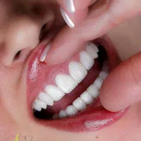 ایمپلنت،دندان مصنوعی ،اوردنچر،باشرایط اقساطی ویژه|خدمات آرایشگری و زیبایی|تهران, مجیدیه|دیوار