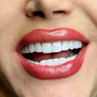 کامپوزیت زیبایی