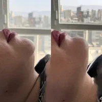 تزریق ژل و بوتاکس و مادلینگ عربی|خدمات آرایشگری و زیبایی|کرمانشاه, |دیوار