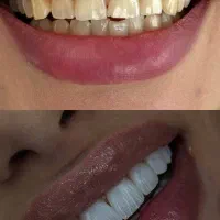 کامپوزیت سارمکو فکی هشت تومن