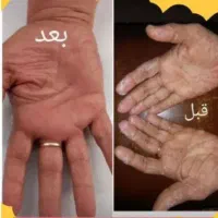 روغن های معجزه گر مون شارژ شده