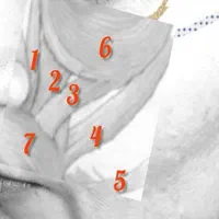اموزش صفرتاصد عارضه های پوست|خدمات آموزشی|تهران, آهنگ|دیوار