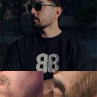 معجزه ریش وسیبیل