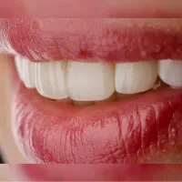 استخدام دستیار دندانپزشکی