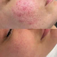 فشیال پاکسازی آموزش تخصصی درمانی همراه مدرک|خدمات آموزشی|تهران, بریانک|دیوار