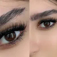 کاشت مژه هیدن