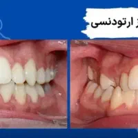 دندانپزشکی تخصصی ارتودنسی(مرتب کردن دندان ها) قسطی|خدمات آرایشگری و زیبایی|اهواز, شهرک حفاری|دیوار