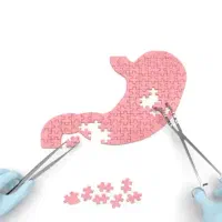 بوتاکس معده کاهش وزن تضمینی