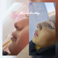 ژل لب|خدمات آرایشگری و زیبایی|خوی, |دیوار