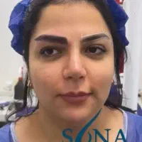 مو طبیعی انقد طبیعی که باورش سخته فقط ۲۰ تومن