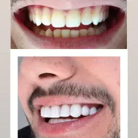 دندانسازی فولادشهر مسکن مهر