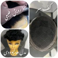 تعویض چسب پروتز مو در محل|خدمات آرایشگری و زیبایی|تهران, شکوفه|دیوار