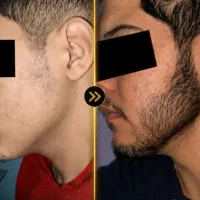 به جذابیت برس