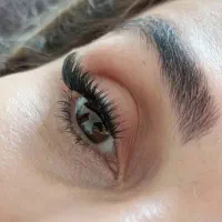 کاشت موقت هیدن