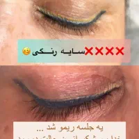 ریمو تتوی صورت(فقط بانوان)|خدمات آرایشگری و زیبایی|قم, کیوانفر|دیوار
