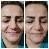 مشاوره رایگان پوست و مو