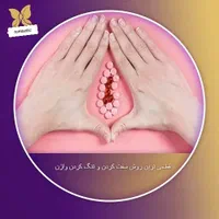 هایفو،قطعی ترین روش تنگ کردن واژن ولیفت صورت،|خدمات آرایشگری و زیبایی|مشهد, کوی المهدی|دیوار