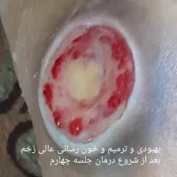 بخیه و تزریقات و پانسمان پیشرفته|خدمات آرایشگری و زیبایی|اهواز, منازل کارون|دیوار