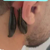 زالو فصد حجامت طب سوزنی طب سنتی بادکش گرم و سرد|خدمات آرایشگری و زیبایی|اصفهان, طامه|دیوار